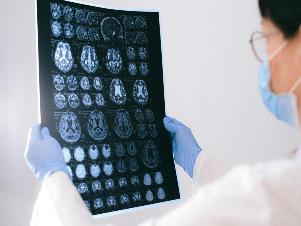 Medical Billing Services for Neurologists